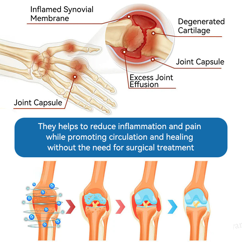 🇬🇧🔥𝐉𝐨𝐢𝐧𝐭 𝐇𝐞𝐚𝐥𝐢𝐧𝐠 𝐂𝐫𝐞𝐚𝐦🦴(𝐟𝐥𝐲𝐬𝐦𝐮𝐬® )