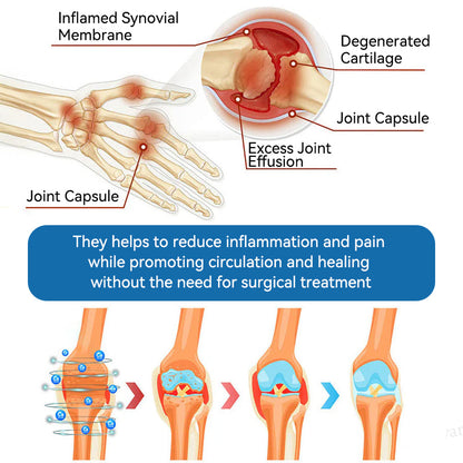 🇬🇧🔥𝐉𝐨𝐢𝐧𝐭 𝐇𝐞𝐚𝐥𝐢𝐧𝐠 𝐂𝐫𝐞𝐚𝐦🦴(𝐟𝐥𝐲𝐬𝐦𝐮𝐬® )