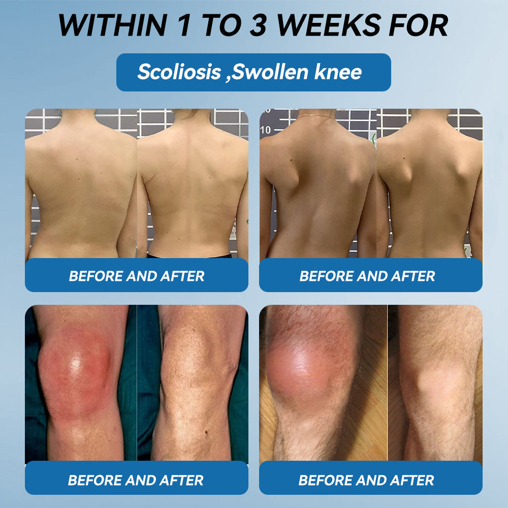 🇬🇧🔥𝐉𝐨𝐢𝐧𝐭 𝐇𝐞𝐚𝐥𝐢𝐧𝐠 𝐂𝐫𝐞𝐚𝐦🦴(𝐟𝐥𝐲𝐬𝐦𝐮𝐬® )