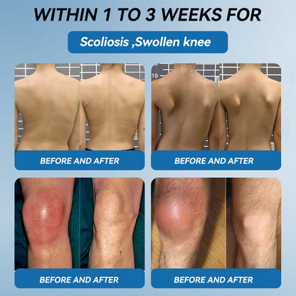 🇬🇧🔥𝐉𝐨𝐢𝐧𝐭 𝐇𝐞𝐚𝐥𝐢𝐧𝐠 𝐂𝐫𝐞𝐚𝐦🦴(𝐟𝐥𝐲𝐬𝐦𝐮𝐬® )