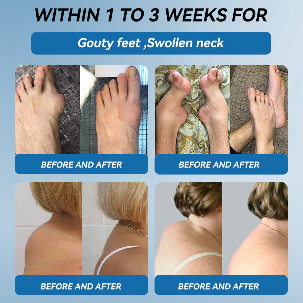 🇬🇧🔥𝐉𝐨𝐢𝐧𝐭 𝐇𝐞𝐚𝐥𝐢𝐧𝐠 𝐂𝐫𝐞𝐚𝐦🦴(𝐟𝐥𝐲𝐬𝐦𝐮𝐬® )