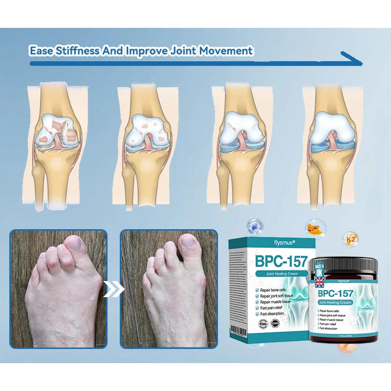 💠𝐟𝐥𝐲𝐬𝐦𝐮𝐬®𝐁𝐏𝐂-𝟏𝟓𝟕𝐉𝐨𝐢𝐧𝐭 𝐇𝐞𝐚𝐥𝐢𝐧𝐠 𝐂𝐫𝐞𝐚𝐦🦴